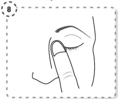 schema_appuyer_coin_interne_oeil_8-V1-20151105