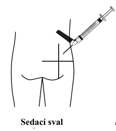A syringe being injected into the side of the body
Description automatically generated