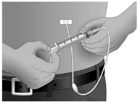 If the needle was not inserted properly, repeat the priming and insertion of the needle