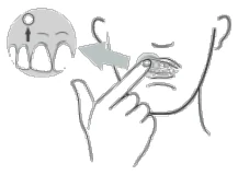Descriptive graphic for patient information leaflet; described in leaflet text